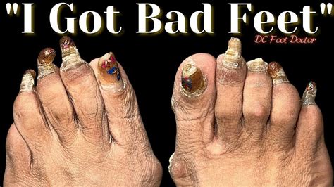 Gross Feet Photos, Download The BEST Free Gross Feet Stock。